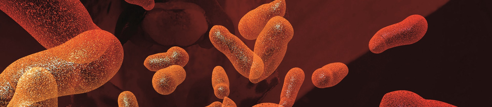 Legionella